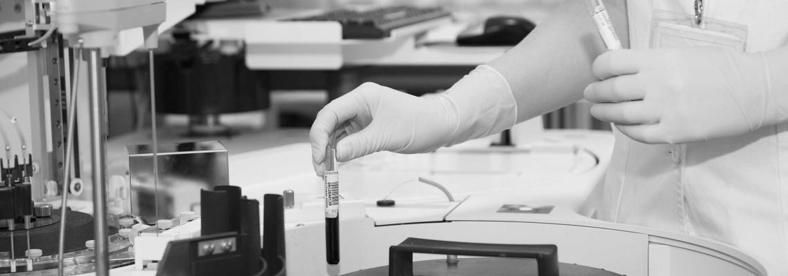 17025, исо, лаборатории, измерване, метод за измерване. laboratory, standard, iso, стандарт, акредитация